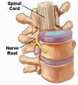 neck pain